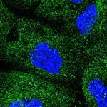 COQ2 Polyclonal Antibody