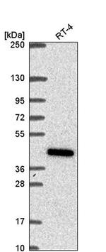 COQ2 Antibody in Western Blot (WB)
