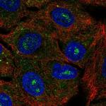 CACNG6 Polyclonal Antibody