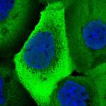 UBA52 Polyclonal Antibody