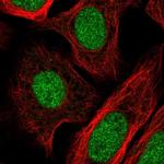 GTF2IRD2B Polyclonal Antibody