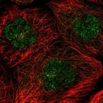 C20orf177 Polyclonal Antibody