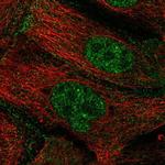 ZGPAT Polyclonal Antibody