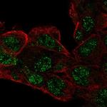 RCBTB1 Polyclonal Antibody
