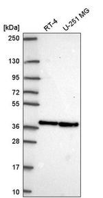 ARGLU1 Antibody in Western Blot (WB)