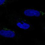 MGAT2 Antibody in Immunocytochemistry (ICC/IF)