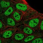 HOXD1 Polyclonal Antibody