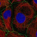 PKP2 Polyclonal Antibody