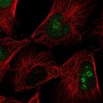 FAM3A Polyclonal Antibody