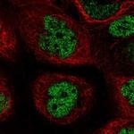PALB2 Antibody in Immunocytochemistry (ICC/IF)