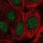 Gemin 2 Polyclonal Antibody