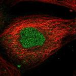 AMMECR1L Polyclonal Antibody