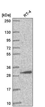 AMMECR1L Antibody in Western Blot (WB)