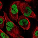 CAD Polyclonal Antibody