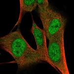 ZFP3 Polyclonal Antibody