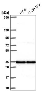V-ATPase C1 Antibody in Western Blot (WB)