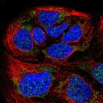 HPDL Polyclonal Antibody