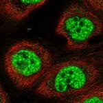 RBM10 Polyclonal Antibody