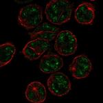 PCP2 Polyclonal Antibody