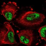 DDX46 Polyclonal Antibody