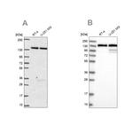 DDX46 Antibody in Western Blot (WB)