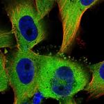 TTC1 Polyclonal Antibody