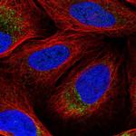 DNA2 Polyclonal Antibody