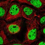 RSF1 Polyclonal Antibody