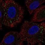 CCDC65 Polyclonal Antibody