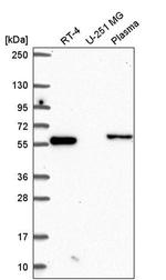 CCDC65 Antibody in Western Blot (WB)