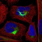 PJA2 Polyclonal Antibody