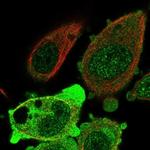 ANKRD36 Antibody in Immunocytochemistry (ICC/IF)