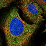 Growth Hormone Receptor Polyclonal Antibody