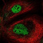 NEMP2 Antibody in Immunocytochemistry (ICC/IF)