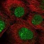 MFSD1 Antibody in Immunocytochemistry (ICC/IF)