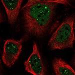 SAB Polyclonal Antibody