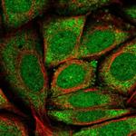 GK5 Polyclonal Antibody