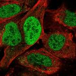 TATD2 Antibody in Immunocytochemistry (ICC/IF)