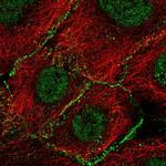 AGO2 Polyclonal Antibody