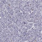 DOCK10 Antibody in Immunohistochemistry (Paraffin) (IHC (P))