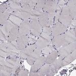DOCK10 Antibody in Immunohistochemistry (Paraffin) (IHC (P))