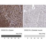 DOCK10 Antibody in Immunohistochemistry (IHC)