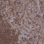 DOCK10 Antibody in Immunohistochemistry (IHC)