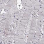 DOCK10 Antibody in Immunohistochemistry (IHC)