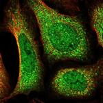 DOCK10 Polyclonal Antibody