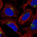 AP1AR Polyclonal Antibody