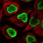 NUP54 Polyclonal Antibody