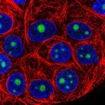 NOP16 Polyclonal Antibody