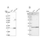 NOP16 Antibody in Western Blot (WB)