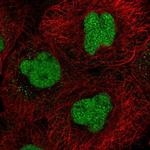 CXXC5 Polyclonal Antibody